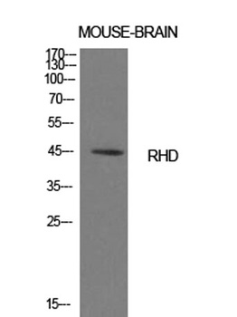 CD240d antibody