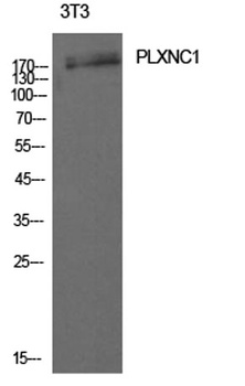 CD232 antibody