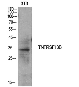 CD267 antibody
