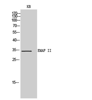 EMAP II rabbit pAb Antibody