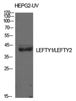 Lefty antibody