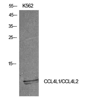 MIP-1b antibody