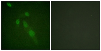 Acetyl Lys proteins rabbit pAb