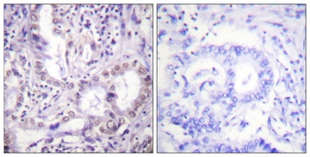 Acetyl Lys proteins rabbit pAb Antibody