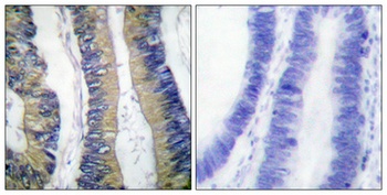 4E-BP1 (phospho Thr69) rabbit pAb