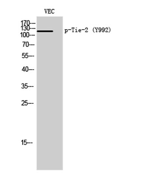 Tie-2 (phospho-Tyr992) antibody