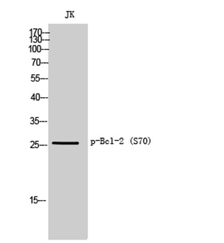 Bcl-2 (phospho-Ser70) antibody