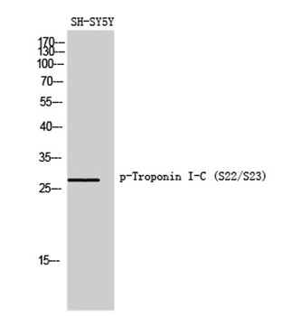 Troponin I-C (phospho-Ser22/S23) antibody