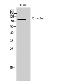 P-cadherin rabbit pAb