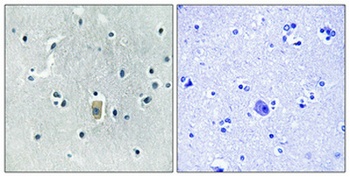 Bim (phospho Ser59) rabbit pAb