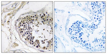 Cystatin 8 rabbit pAb