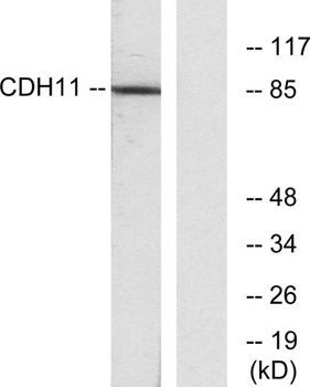 OB-cadherin rabbit pAb Antibody
