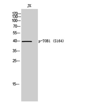 TOB1 (phospho-Ser164) antibody