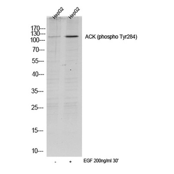 ACK (phospho-Tyr284) antibody