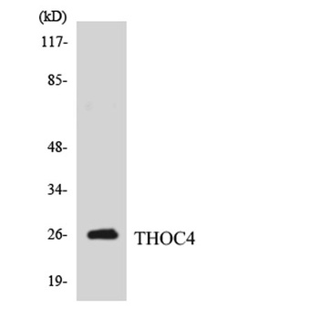 ALY rabbit pAb Antibody