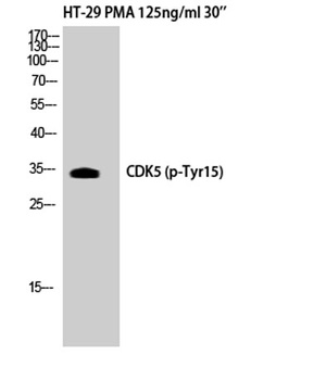Cdk5 (phospho-Tyr15) antibody