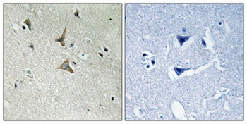 Cdk5 (phospho Tyr15) rabbit pAb Antibody
