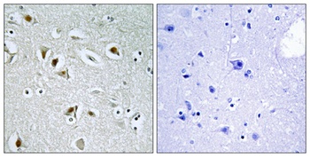 DOC-1R antibody