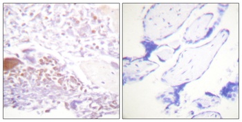 p57 (phospho Thr310) rabbit pAb Antibody