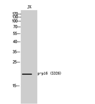 p16 (phospho-Ser326) antibody