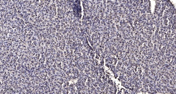 PAK4 (phospho-Ser474) antibody