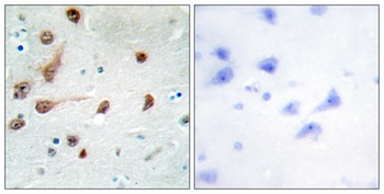 ADAR1 antibody