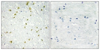 SNAPC 19 antibody