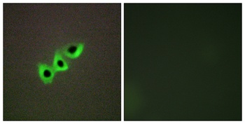 DLC-1 rabbit pAb Antibody