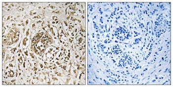 CIB2 antibody