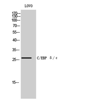 C/EBP delta/Epsilon antibody