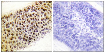 TIP60 rabbit pAb Antibody