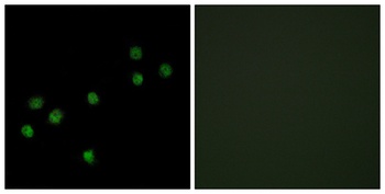 CENP-A antibody