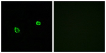 IRE1 alpha/beta antibody