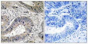 IREβ rabbit pAb Antibody
