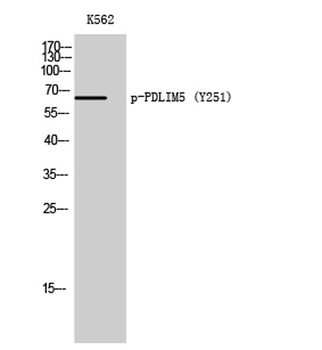 PDLIM5 (phospho-Tyr251) antibody