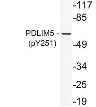 PDLIM5 (phospho Tyr251) rabbit pAb Antibody