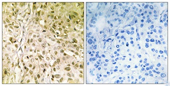 DNA pol θ rabbit pAb