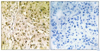 DNA pol Theta antibody