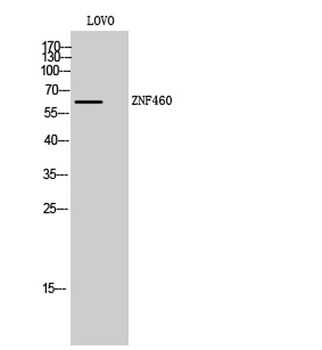 ZNF460 antibody