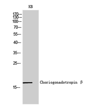 Choriogonadotropin beta antibody