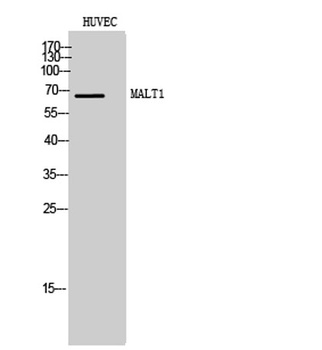 MALT1 antibody