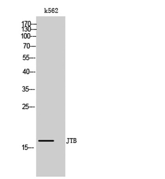 JTB antibody