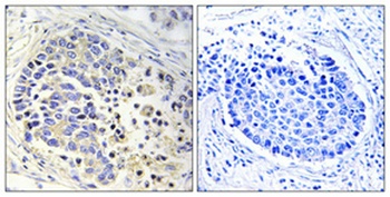 ACOT2 rabbit pAb Antibody