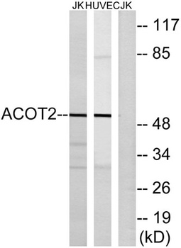 ACOT2 rabbit pAb Antibody