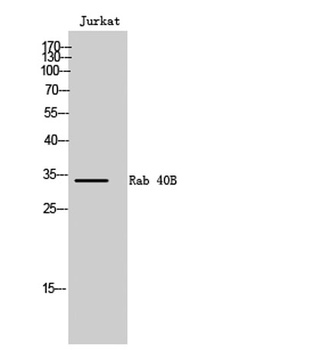Rab 40B antibody