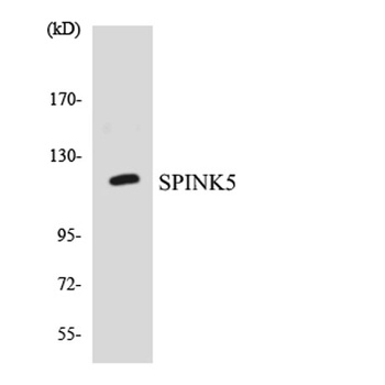 LEKTI antibody