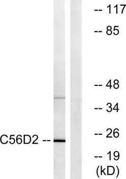 CYB561D2 rabbit pAb Antibody