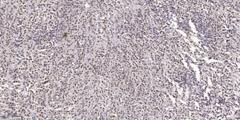 SCG10 (phospho-Ser73) antibody