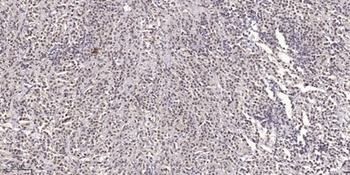 SCG10 (phospho Ser73) rabbit pAb