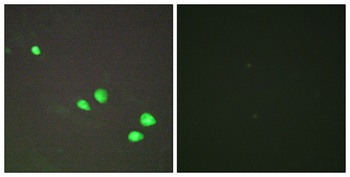 Mi2-beta antibody